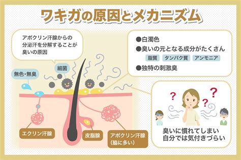 外国人にワキガが多い理由は？ワキガに対する考え方と臭いケア。